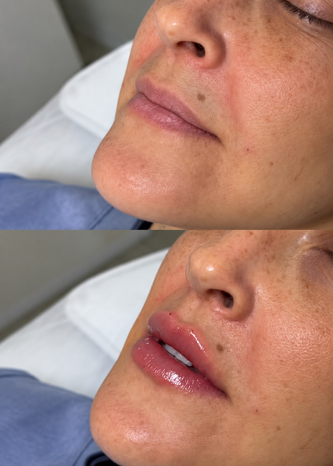 Full Face